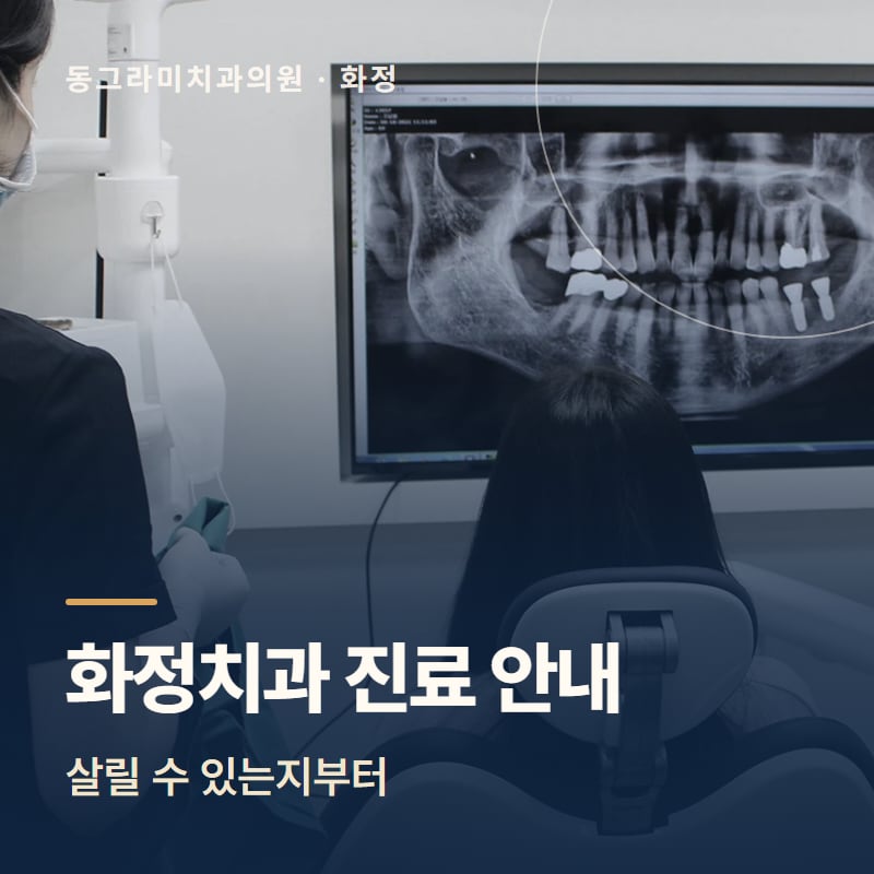 화정치과 진료 안내, 살릴 수 있는지부터